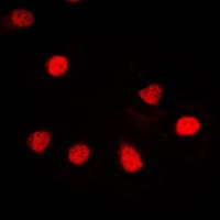 ZNF187 Antibody (Internal)