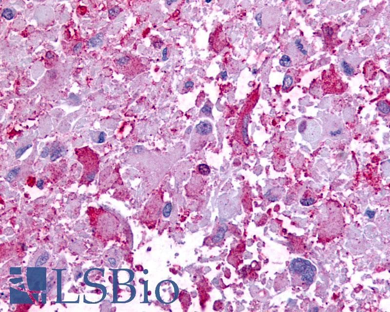 IHC-plus™ GPR45 Antibody (N-Terminus)