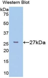 FKBP25 / FKBP3 Antibody (aa2-224)