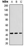 Polyclonal Rabbit anti-Human CHI3L1 / YKL-40 Antibody (Internal, WB)