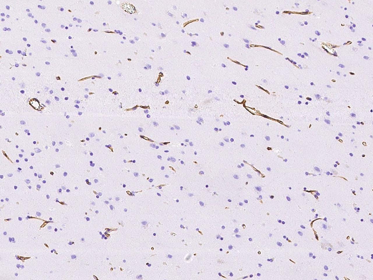 NES / Nestin Antibody (clone 11, Preservative Free)