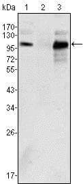 Monoclonal Mouse anti-Human AR / Androgen Receptor Antibody (clone 2H8, IHC, WB)