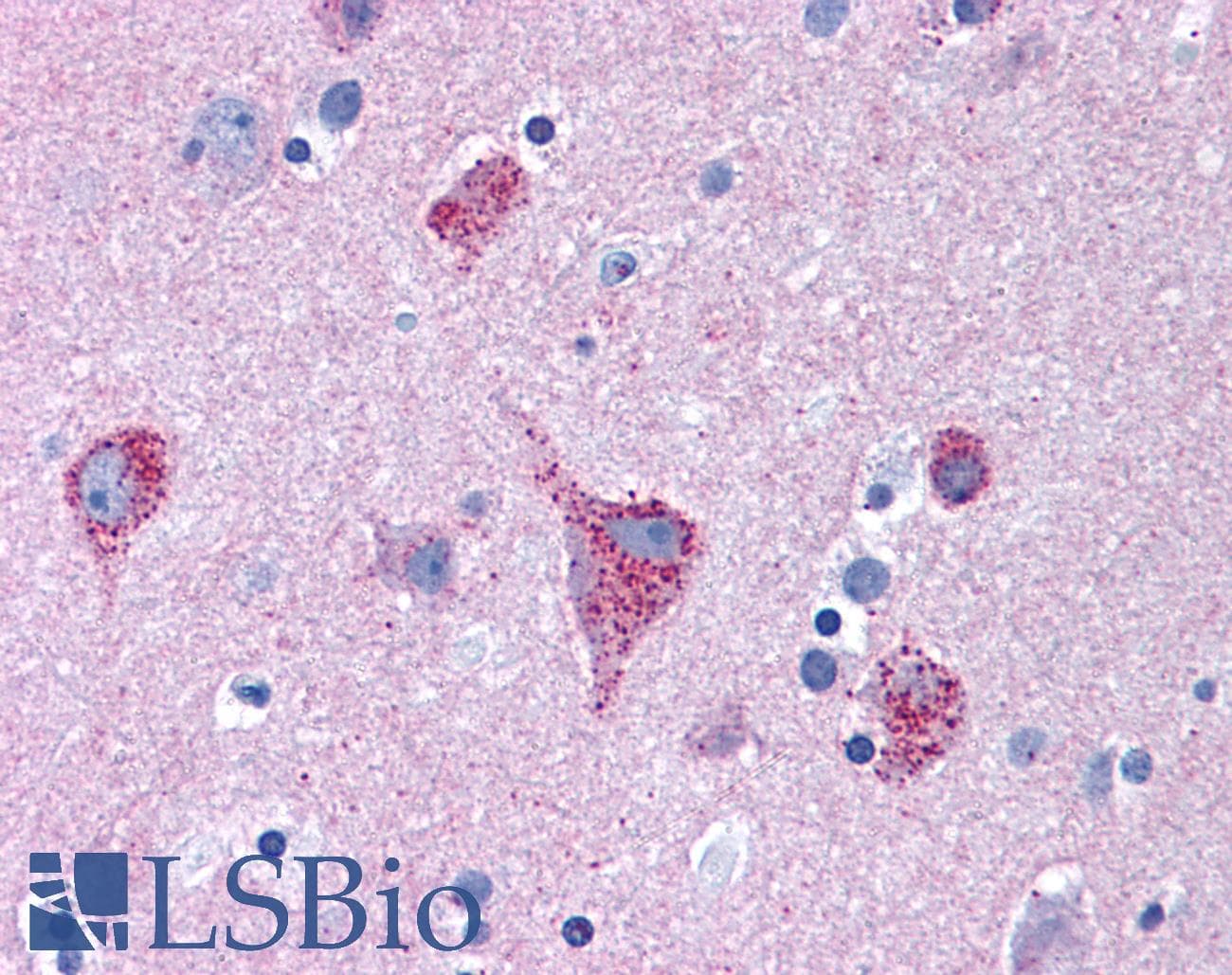 IHC-plus™ STXBP1 / MUNC18-1 Antibody (aa591-603)