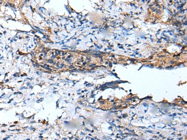 Polyclonal Rabbit anti-Human DEFB104A / BD-4 Antibody (IHC)