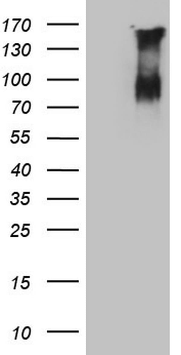 F13B / TGase Antibody (aa357-661, clone OTI2D4)