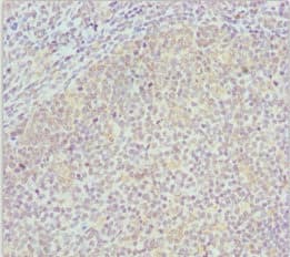 Polyclonal Rabbit anti-Human COG4 Antibody (IHC, WB)