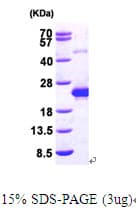 Human DCTD / dCMP Deaminase Protein (Recombinant His)