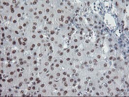 TPRKB Antibody (clone OTI3H3)