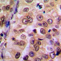 Polyclonal Rabbit anti-Human IKBKG / NEMO / IKK Gamma Antibody (Internal, IHC, IF, WB)