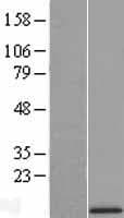 Human UQCR10 / UCRC Protein (Over-Expression Lysate Myc-DDK (Flag))