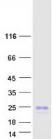 Human WFDC2 / HE4 Protein (Recombinant Myc-DDK (Flag))