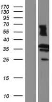 RDH13 Protein (Over-Expression Lysate Myc-DDK (Flag))