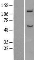 ATP6V1B2 Protein (Over-Expression Lysate Myc-DDK (Flag))