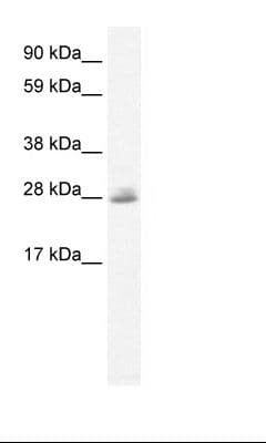 CLIC5 Antibody (C-Terminus)
