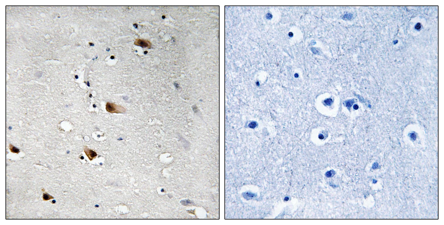 Polyclonal Rabbit anti-Human TCF3 / E2A Antibody (phospho-Thr355, IHC)