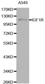 IGF1R / IGF1 Receptor Antibody