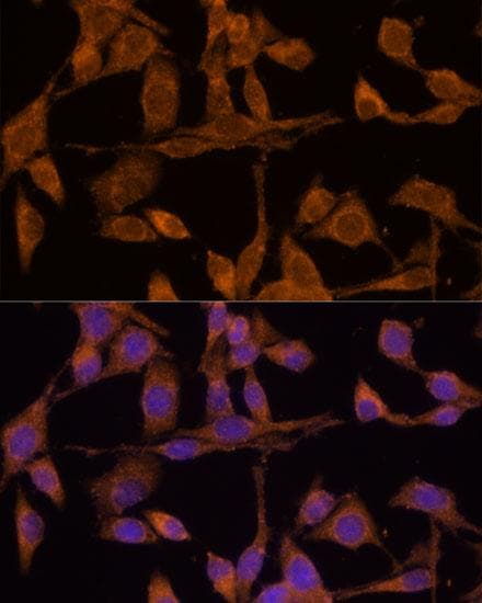 USP15 Antibody