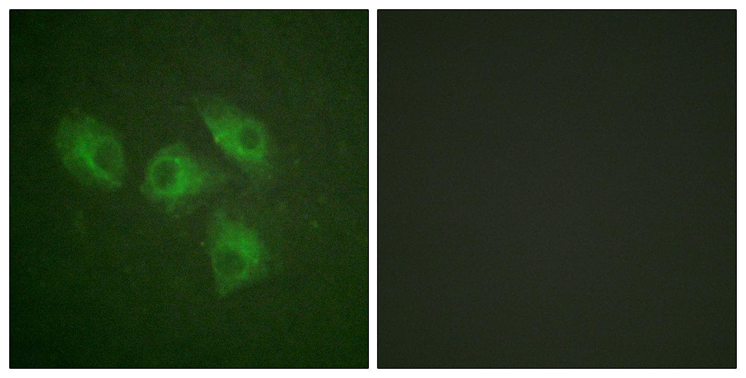 PIK3R1 / p85 Alpha Antibody (Ab-607)