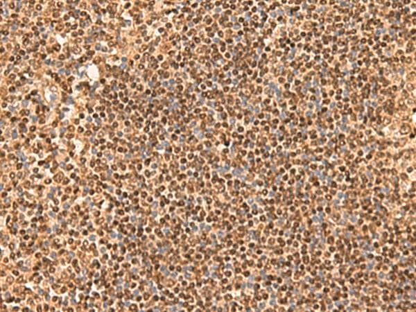 SIX6 Antibody