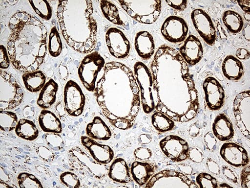 MCAD / ACADM Antibody (clone OTI10A5, Carrier-free)