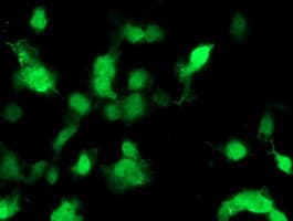 PMVK Antibody (clone OTI1C12)