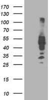 IRF6 Antibody (clone OTI1D4)