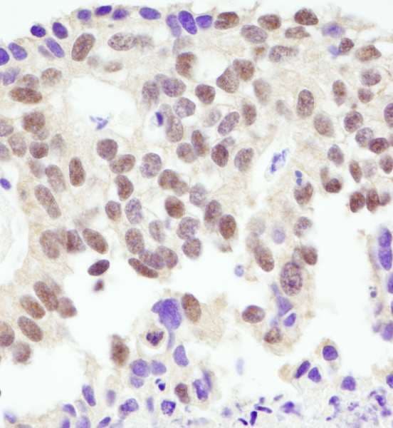 BRCA1 Antibody (aa700-750)