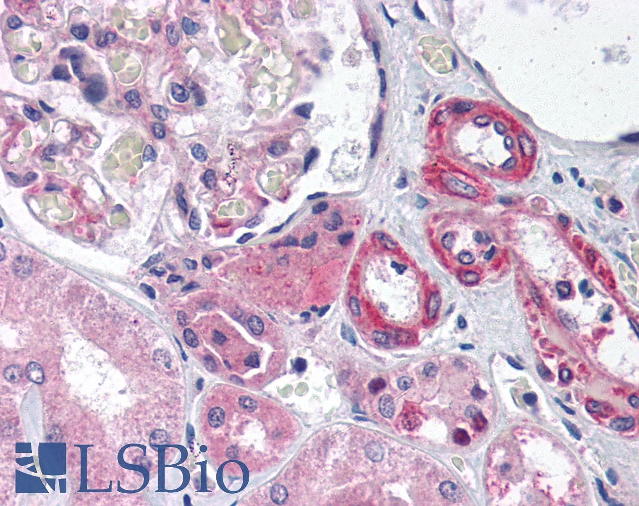 GIPC1 / GIPC Antibody (aa40-89)