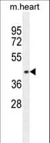 AP1M1 Antibody (aa205-234)