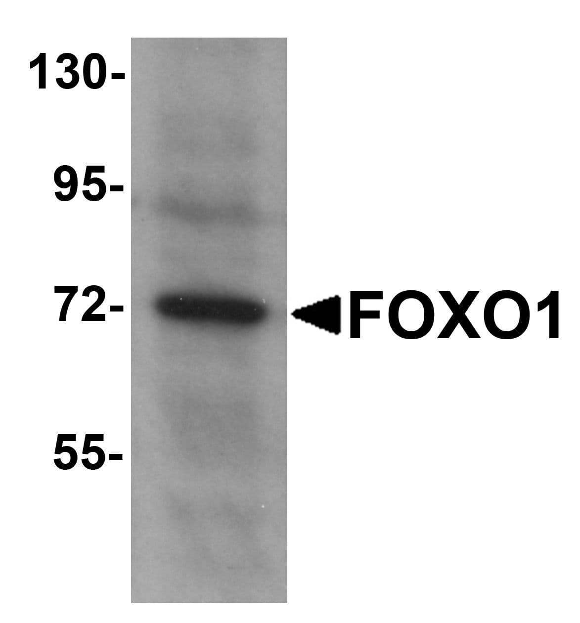 PathPlus™ FOXO1 / FKHR Antibody