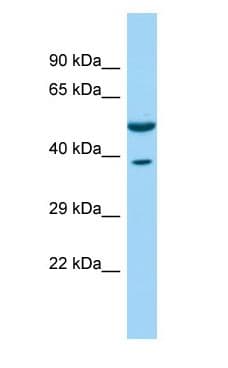 CORO1C Antibody (aa402-451)