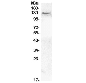 CACNA2D2 Antibody