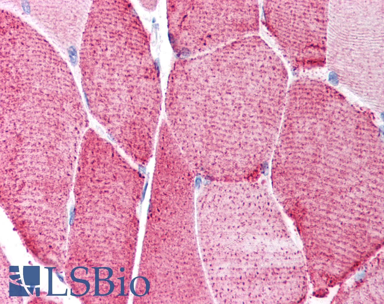 HDAC6 Antibody (aa69-118)