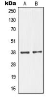 Polyclonal Rabbit anti-Human NKX2-1 / Thyroid-Specific TF Antibody (N-Terminus, WB)