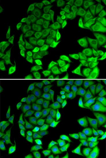 RPL14 / Ribosomal Protein L14 Antibody