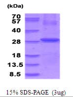 Human FOLR1 / Folate Receptor Alpha Protein (Recombinant His)
