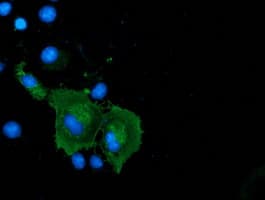 Monoclonal Mouse anti-Human CORO1A / Coronin 1a Antibody (clone OTI1A5, IF, WB)