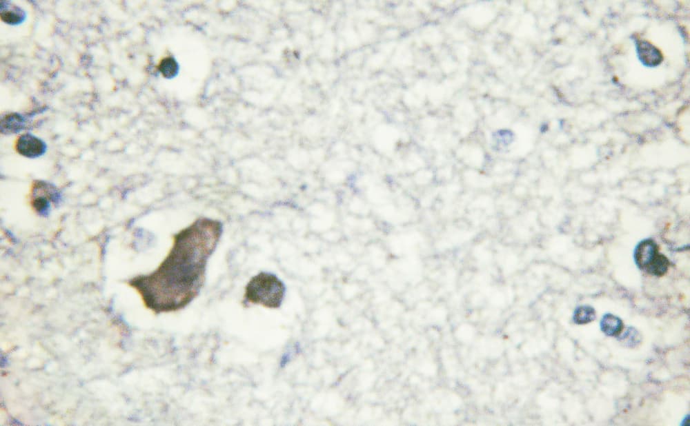 GRIN2B / NMDAR2B / NR2B Antibody (phospho-Tyr1474)