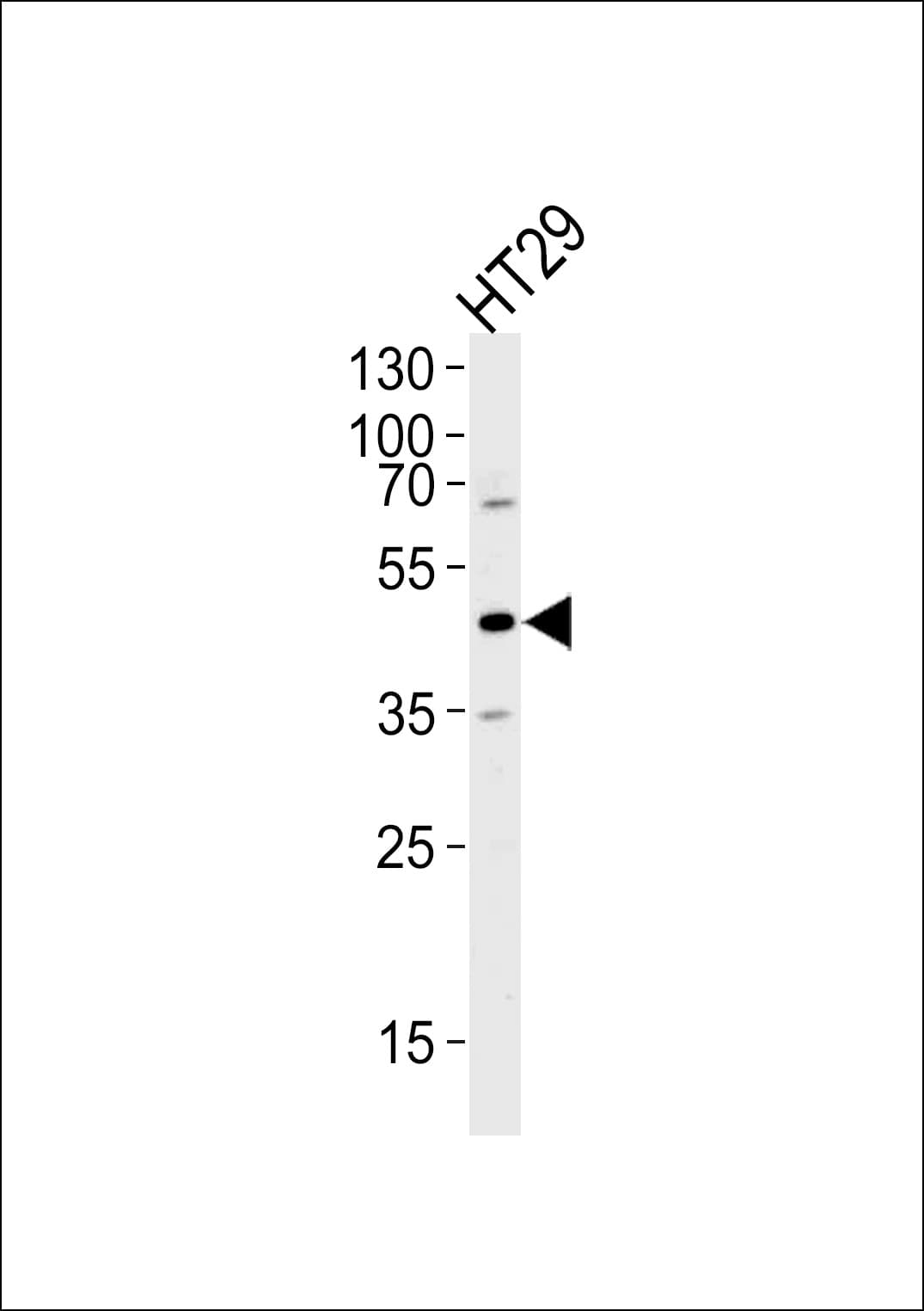 RNH1 Antibody (aa425-454)