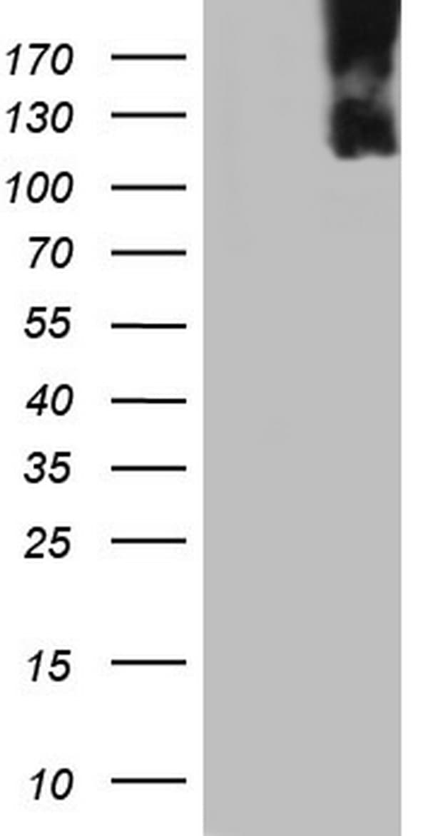 Monoclonal Mouse anti-Human MCM2 Antibody (clone OTI3B12, IHC, WB)