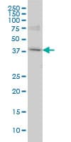 POLR1C / RPA39 Antibody (clone M1)