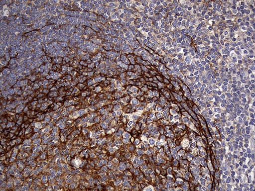 FAM151B Antibody (clone OTI1F5)