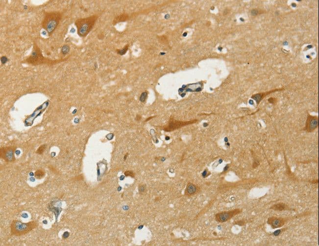 Polyclonal Rabbit anti-Human KLC1 / Kinesin Light Chain 1 Antibody (IHC, WB)