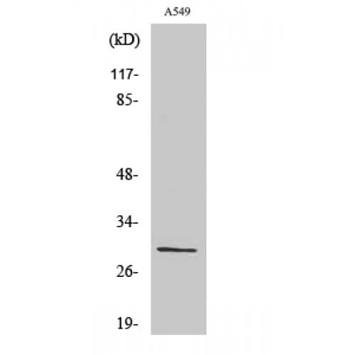RPS8 / Ribosomal Protein S8 Antibody (80-160 aa, Internal)