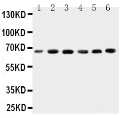 Polyclonal Rabbit anti-Human CETP Antibody (aa368-382, WB)