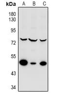 Polyclonal Rabbit anti-Human MKNK2 / MNK2 Antibody (WB)
