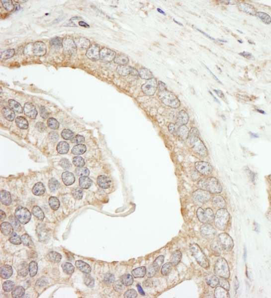 Polyclonal Rabbit anti-Human ABCF2 Antibody (aa573-623, IHC, WB)