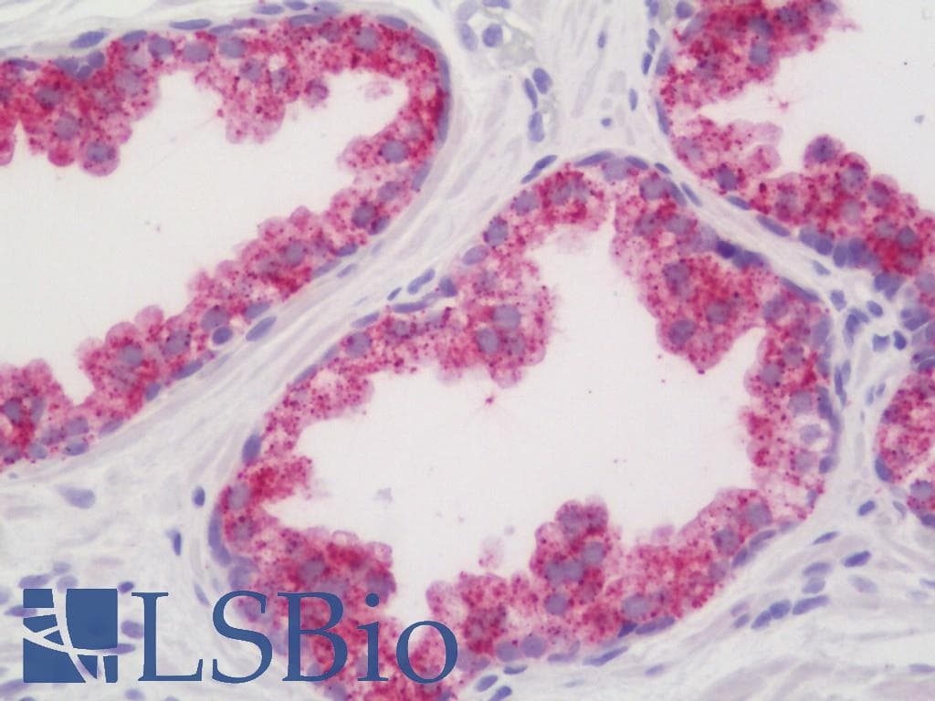 IHC-plus™ ARG2 / Arginase 2 Antibody (aa305-354)