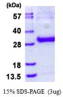 Human TK1 / TK / Thymidine Kinase Protein (Recombinant His)
