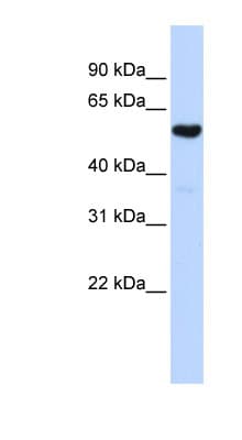 QRSL1 / GatA Antibody (aa432-481)